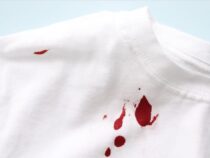 Best Way to Remove Blood Stains Out of Clothes